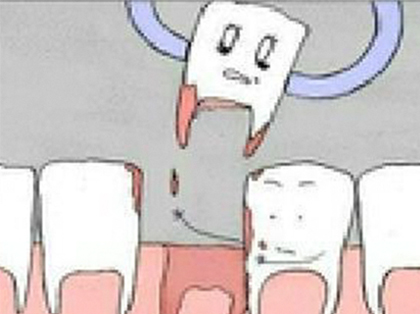 <b>矫正牙齿一定要先拔牙吗</b>