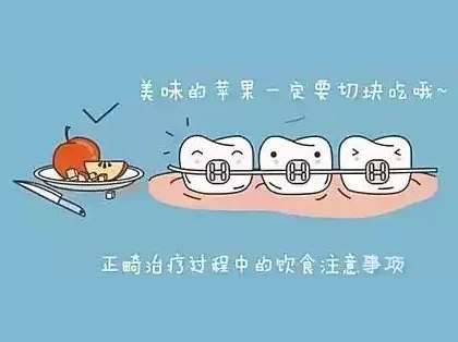 <b>牙齿矫正需要多长时间</b>