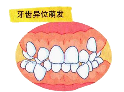 <b>牙齿不好会遗传吗？</b>